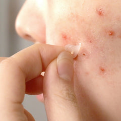 SOME BY MI - 30 Days Miracle Clear Spot Patch 18pcs